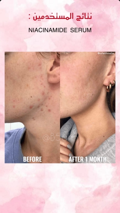 Good molecules, Niacinamide Serum